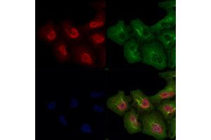 MKK3/MKK6 Antibody staining A549 cells by IF/ICC. (MAP2K3 anticorps)