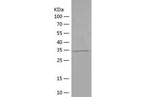 Western Blotting (WB) image for Ataxin 2 (ATXN2) (AA 1-165) protein (His tag) (ABIN7121916)
