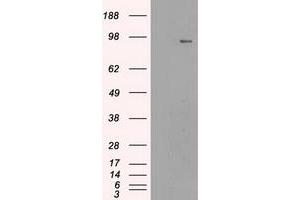 Image no. 7 for anti-Neurotrophic tyrosine Kinase, Receptor, Type 3 (NTRK3) antibody (ABIN1499842)