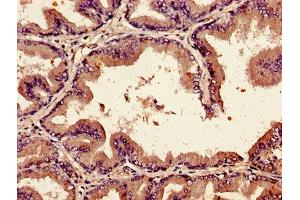 Immunohistochemistry of paraffin-embedded human prostate tissue using ABIN7145684 at dilution of 1:100 (BMP2 anticorps  (AA 283-396))