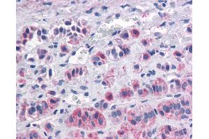 Anti-OX1R / Orexin Receptor 1 antibody IHC of human Adrenal, Pheochromocytoma.