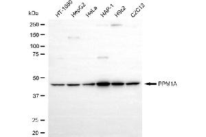 anti-Protein Phosphatase, Mg2+/Mn2+ Dependent, 1A (PPM1A) antibody