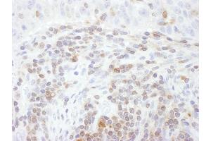 Immunohistochemistry (IHC) image for anti-Signal Transducer and Activator of Transcription 5A (STAT5A) (AA 744-794) antibody (ABIN7453648) (STAT5A anticorps  (AA 744-794))