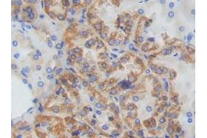 DAB staining on IHC-P; Samples: Human Kidney Tissue