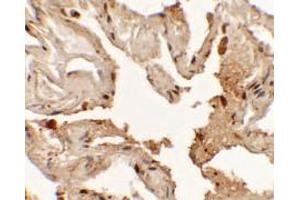 Immunohistochemistry of NKX2-1 in human lung tissue with NKX2-1 antibody at 2. (NKX2-1 anticorps  (N-Term))