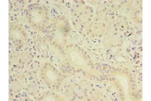 Immunohistochemistry of paraffin-embedded human pancreatic tissue using ABIN7165891 at dilution of 1:100 (OSR2 anticorps  (AA 101-276))