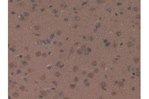 DAB staining on IHC-P; Samples: Rat Brain Tissue (Orexin A anticorps  (AA 32-123))