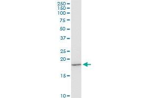 EIF1AY monoclonal antibody (M01), clone 1B4.