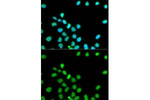 Immunofluorescence analysis of HeLa cells using Lamin A/C antibody. (Lamin A/C anticorps)