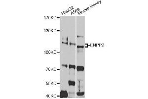 Western blot analysis of extracts of various cell lines, using ENPP2 antibody. (ENPP2 anticorps)