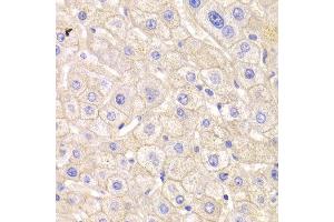 Immunohistochemistry of paraffin-embedded Human liver using CTNND1 antibody at dilution of 1:100 (x400 lens). (CTNND1 anticorps  (AA 573-832))