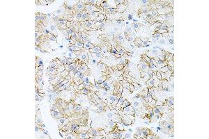 Immunohistochemistry of paraffin-embedded human stomach using IL17A antibody at dilution of 1:100 (x40 lens). (Interleukin 17a anticorps)