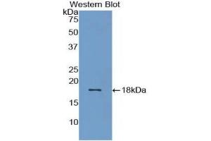 Detection of Recombinant BMP15, Rat using Polyclonal Antibody to Bone Morphogenetic Protein 15 (BMP15) (BMP15 anticorps  (AA 269-391))