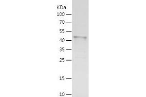 Western Blotting (WB) image for Meis Homeobox 2 (MEIS2) (AA 1-381) protein (His tag) (ABIN7123877)