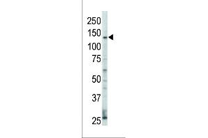 Western blot analysis of anti-ErbB4 Pab (ABIN391950 and ABIN2841748) in HL60 cell lysate.