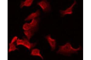 ABIN6275212 staining Hela by IF/ICC. (LDLRAD2 anticorps  (Internal Region))
