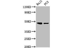 Western Blot Positive WB detected in: Raji whole cell lysate, PC-3 whole cell lysate All lanes: STRADB antibody at 3 μg/mL Secondary Goat polyclonal to rabbit IgG at 1/50000 dilution Predicted band size: 48, 43, 32 kDa Observed band size: 48 kDa