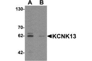 Western blot analysis of KCNK13 in rat brain tissue lysate with KCNK13 Antibody  at 0. (KCNK13 anticorps  (Middle Region))