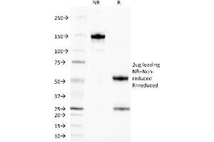 anti-TAG-72 / CA72.4 antibody