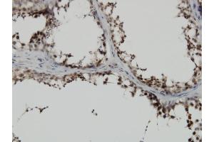 Immunoperoxidase of monoclonal antibody to PBK on formalin-fixed paraffin-embedded human testis.