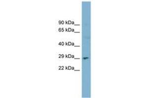 Image no. 1 for anti-Deoxyribonuclease I (DNASE1) (AA 71-120) antibody (ABIN6743430) (DNASE1 anticorps  (AA 71-120))