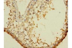 Immunohistochemistry of paraffin-embedded human testis tissue using ABIN7144247 at dilution of 1:100
