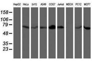 Image no. 4 for anti-LIM Domain Kinase 1 (LIMK1) antibody (ABIN1499146)