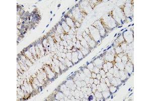 Immunohistochemistry of paraffin-embedded Human rectum using CHMP4B Polyclonal Antibody at dilution of 1:100 (40x lens). (CHMP4B anticorps)