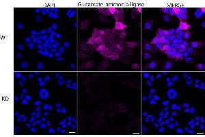 Immunocytochemical staining of HeLa cells using Glutamate-ammonia ligase antibody (ABIN7798741), 1:1,000), Top panel: wild-type (WT), Bottom panal: Glutamate-ammonia ligase shRNA knockdown (KD).