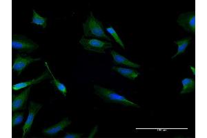Immunofluorescence of purified MaxPab antibody to CALCB on HeLa cell. (CALCB anticorps  (AA 1-127))