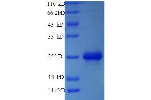 SDS-PAGE (SDS) image for MATRX (AA 1-202), (full length) protein (His tag) (ABIN5714052) (MATRX (AA 1-202), (full length) protein (His tag))