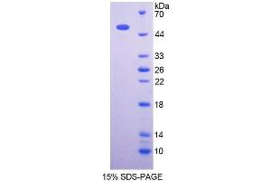 SDS-PAGE analysis of Human OXCT1 Protein. (OXCT1 Protéine)
