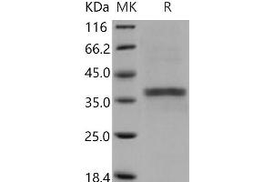 Western Blotting (WB) image for Acid Phosphatase 5, Tartrate Resistant (ACP5) (Active) protein (His tag) (ABIN7194093)