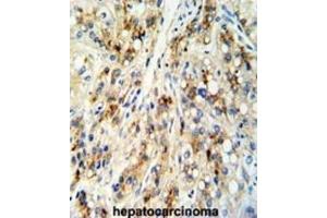Immunohistochemistry (IHC) image for anti-Cat Eye Syndrome Chromosome Region, Candidate 5 (CECR5) antibody (ABIN3003803)