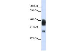 RNASEH1 antibody used at 1 ug/ml to detect target protein. (Ribonuclease H1 anticorps  (Middle Region))