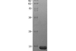 Validation with Western Blot (MIA Protein (His tag))