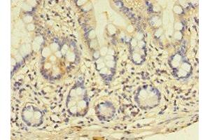 Immunohistochemistry of paraffin-embedded human small intestine tissue using ABIN7163864 at dilution of 1:100