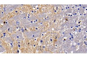 Detection of TLR5 in Rat Cerebrum Tissue using Polyclonal Antibody to Toll Like Receptor 5 (TLR5)