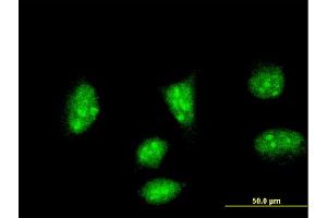 Immunofluorescence of monoclonal antibody to HAND2 on HeLa cell. (HAND2 anticorps  (AA 135-216))
