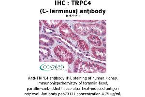 Image no. 1 for anti-Transient Receptor Potential Cation Channel, Subfamily C, Member 4 (TRPC4) (C-Term), (Internal Region) antibody (ABIN1740389) (TRPC4 anticorps  (C-Term, Internal Region))