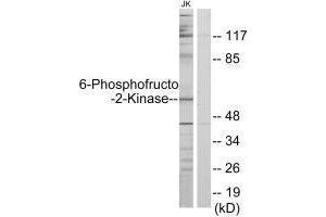 Western blot analysis of extracts from Jurkat cells, using PFKFB2 antibody. (PFKFB2 anticorps  (N-Term))