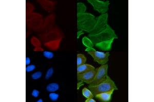 ABIN6263917 and ABIN6272379 staining Hela cells(30 min of UV treatment) by IF/ICC.