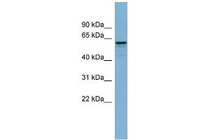WB Suggested Anti-DCTN4 Antibody Titration: 0. (Dynactin 4 anticorps  (N-Term))