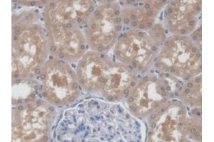 Detection of UPB1 in Human Kidney Tissue using Polyclonal Antibody to Beta-ureidopropionase (UPB1)