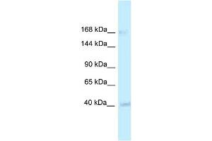 WB Suggested Anti-RGD1563533 Antibody   Titration: 1. (CASZ1 anticorps  (Middle Region))
