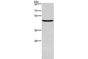 Western Blot analysis of Human testis tissue using DMRT3 Polyclonal Antibody at dilution of 1:550 (DMRT3 anticorps)