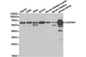 Western Blotting (WB) image for anti-Aldehyde Dehydrogenase 4 Family, Member A1 (ALDH4A1) antibody (ABIN1870929) (ALDH4A1 anticorps)