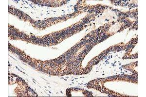 Image no. 8 for anti-ClpP Caseinolytic Peptidase, ATP-Dependent, Proteolytic Subunit Homolog (E. Coli) (CLPP) antibody (ABIN1497535)