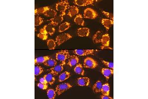 Immunofluorescence analysis of NIH-3T3 cells using  Rabbit pAb (ABIN7265423) at dilution of 1:100 (40x lens). (ACSL1 anticorps  (AA 46-275))