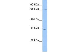 WB Suggested Anti-NR1D2 Antibody Titration:  0.